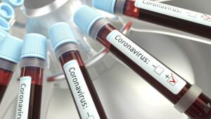 Guaramirim registra 249 casos de coronavírus nesta sexta-feira (14)