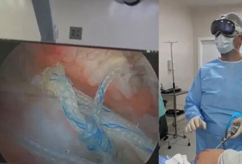 Apple Vision Pro é usado em cirurgia ortopédica em Jaraguá do Sul