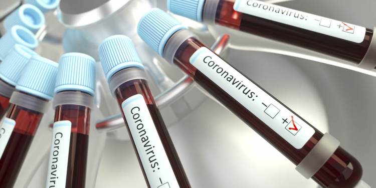 Guaramirim registra 249 casos de coronavírus nesta sexta-feira (14) - Crédito: Ilustração